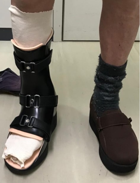 短下肢装具（CROWブーツ）画像