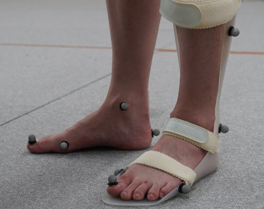 脳卒中・片麻痺 スライド画像